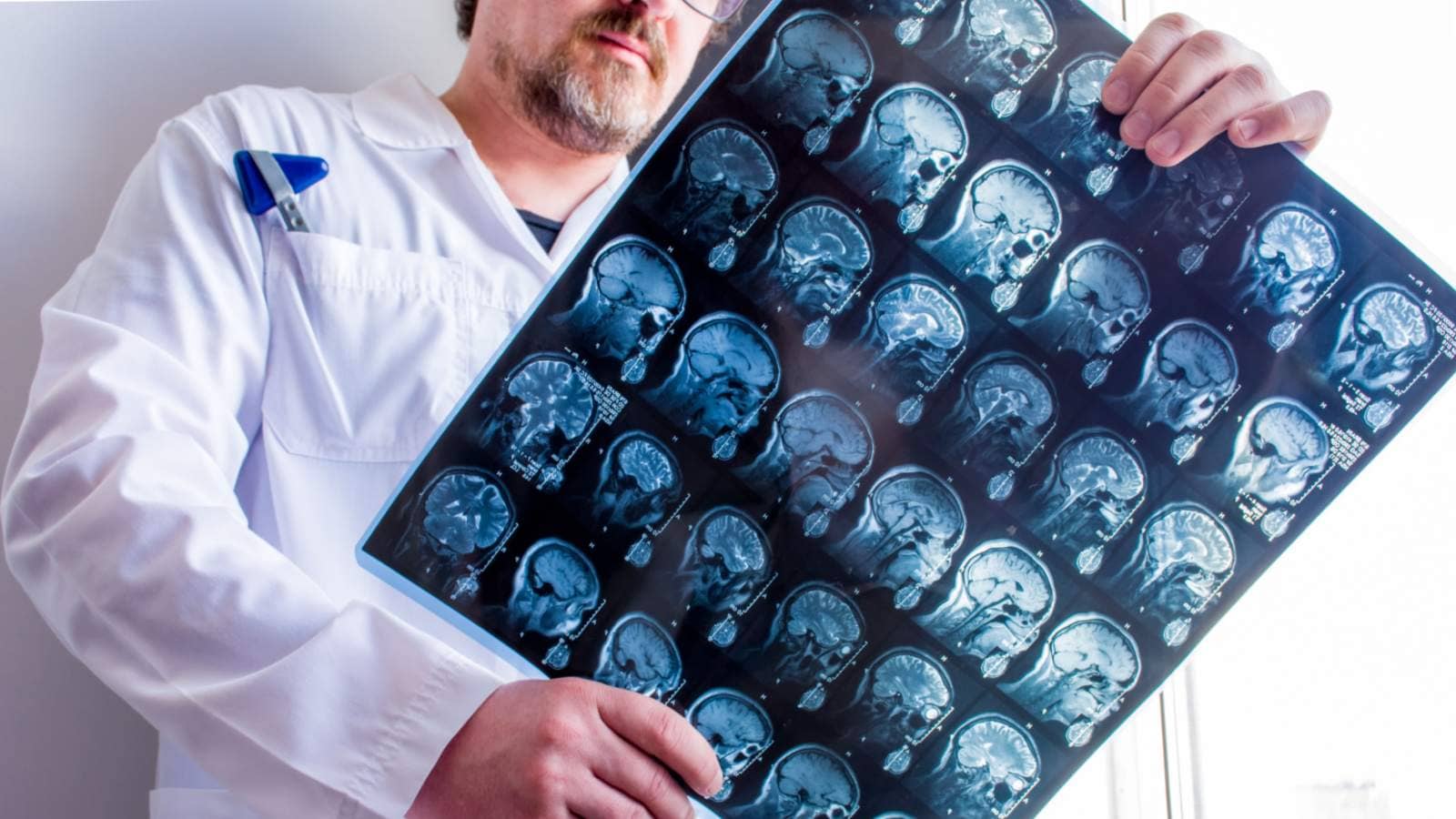 Doctor examines MRI scan result of the head