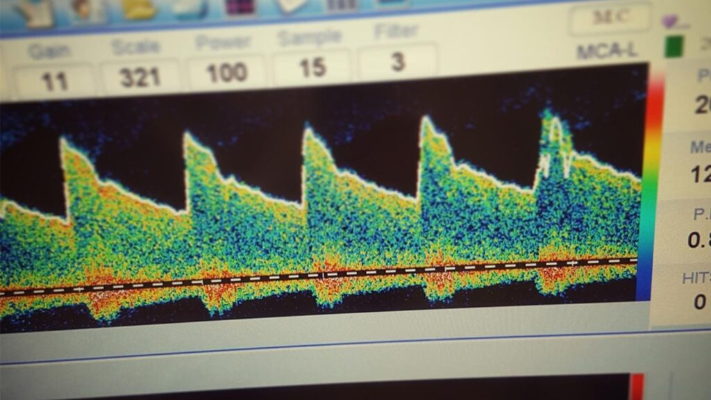 Screen showing transcranial doppler examination results